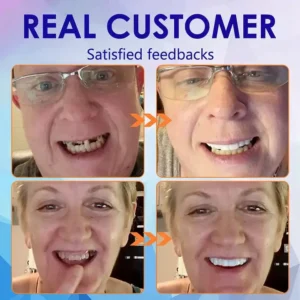 Official Store | Vaxflite™Advanced Full Denture Set 🦷obtained American Dental Association (ADA) certification✅