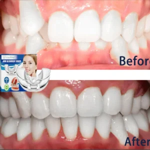 🔥Vaxflite™Mandibular Corrector-For a Healthier, More Aligned Smile🦷🔥