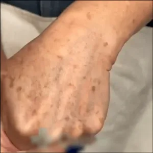 Vaxflite™ Retinol Radiance Cream