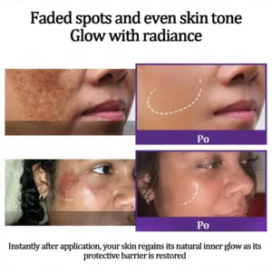 Vaxflite™ Retinol Radiance Cream