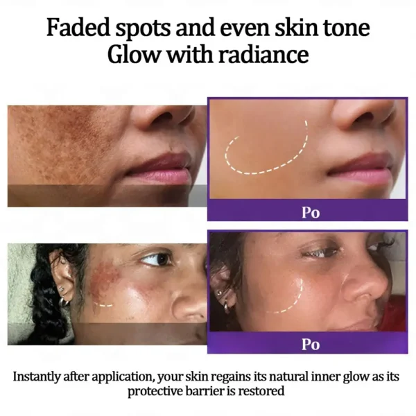 Vaxflite™ Retinol Radiance Cream