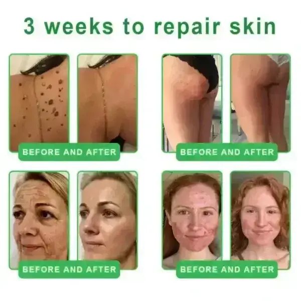 ๐๐ซ๐ข๐๐๐กยฎ ๐๐๐+ ๐-๐ข๐ง-๐ ๐๐๐ซ๐ฆ๐๐๐๐ฉ๐๐ข๐ซ ๐๐๐ซ๐ฎ๐ฆ