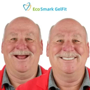EcoSmark GelFit Dentures
