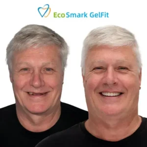 EcoSmark GelFit Dentures