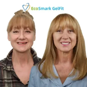 EcoSmark GelFit Dentures