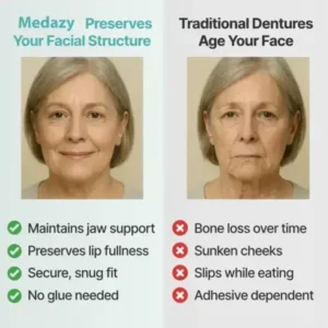 【OFFICIAL STORE】Medazy™ Custom-Fit Full Functional Dentures