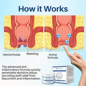 Cvreoz® Hemorrhoid & Fissure Cream