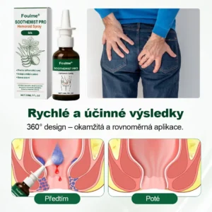 🎄Foulme® SootheMist PRO sprej na hemoroidy🎁
