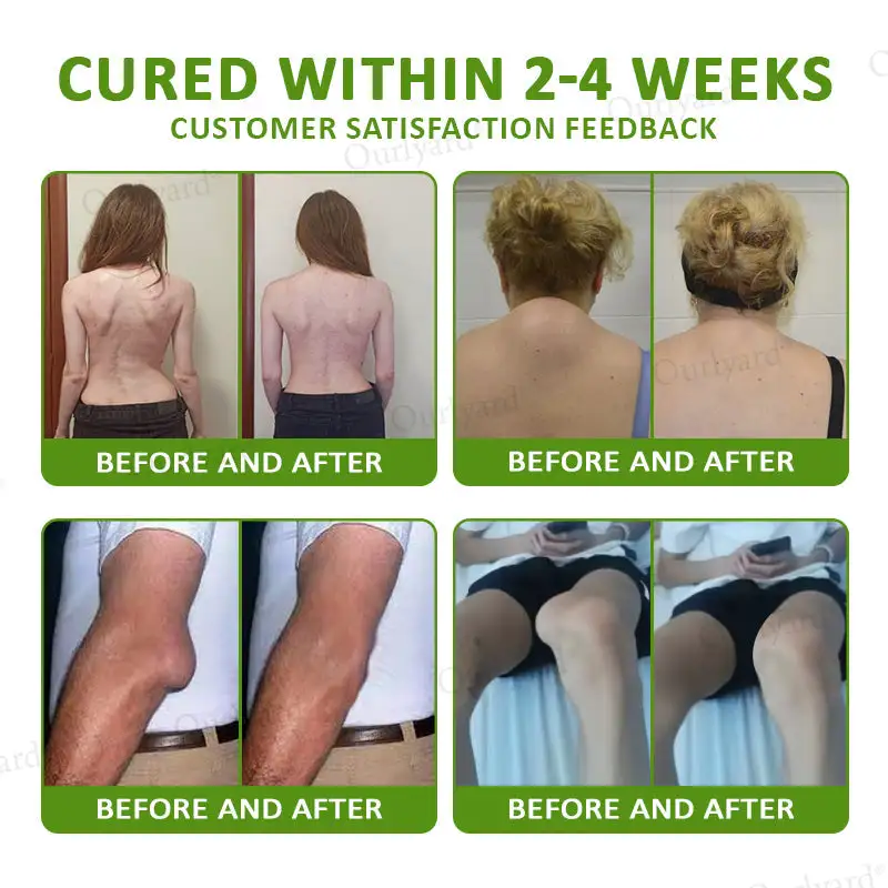 Ourlyard® Magnesium & Peppermint Arthritis Pain Relief and Bone Healing Cream