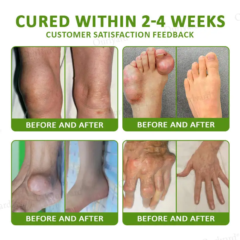 Ourlyard® Magnesium & Peppermint Arthritis Pain Relief and Bone Healing Cream