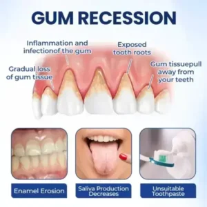 Biancat® BeeTakt Oral Repair Solution