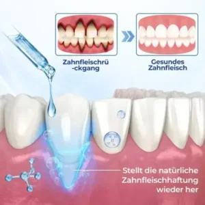 Biancat® BeeTakt Zahnfleisch-Repair Lösung