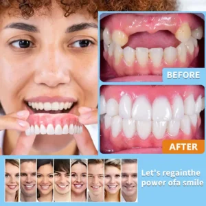 Easy Denture Set, Comfortable Smile Makeover - Made and Shipped from the USA🍀