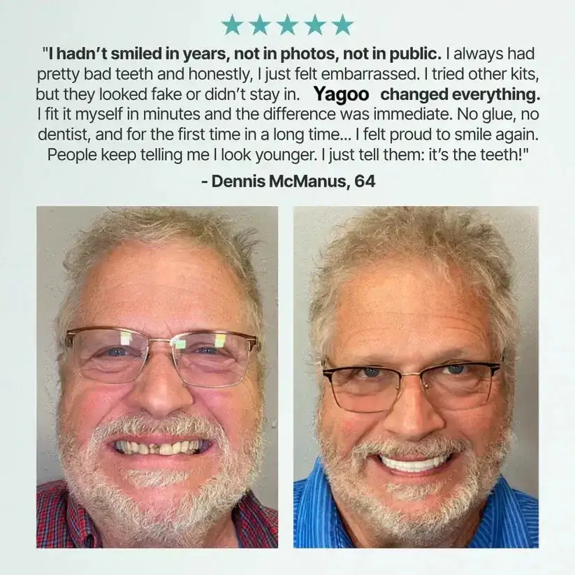 ⏰Ends Today: 70% OFF! 🌎KLENIMORE™ Custom-Fit Dentures— Designed for Comfort and a Natural-Looking Smile