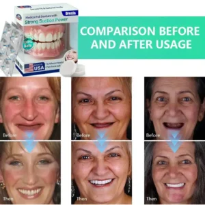🔥Limited Time 50% OFF： 2nd ltem 60% Off🔥HazyGalaxy® Medical Full Denture with Strong Suction ✅ Made and Shipped from the USA🍀