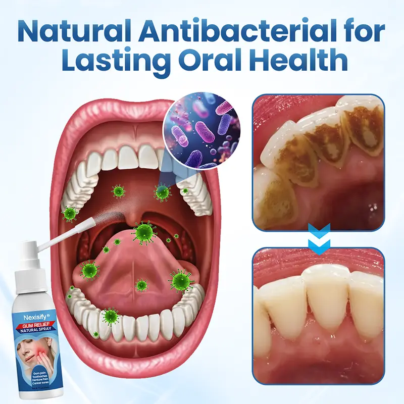 Nexisify® Gum Relief Natural Spray