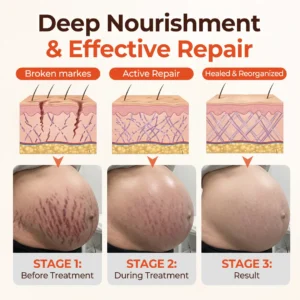 Biancat® SilkStretch Natural Stretch Mark & Scar Oil