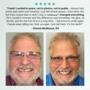 Eubuyercon™ Full Denture