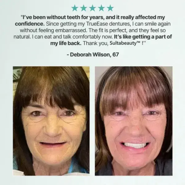 Eubuyercon™ Full Denture