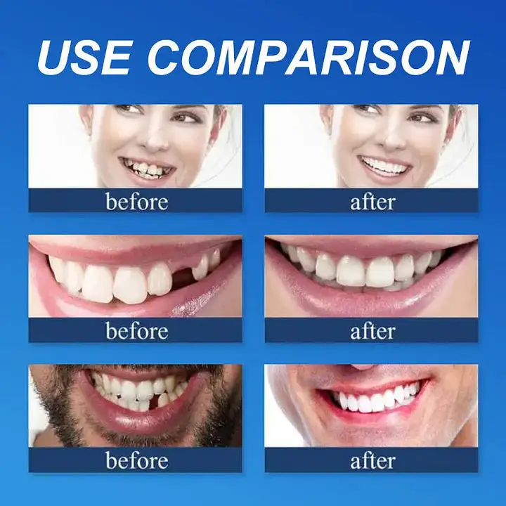 Jakhuors® Premium Denture 2026 | Custom Fit Denture