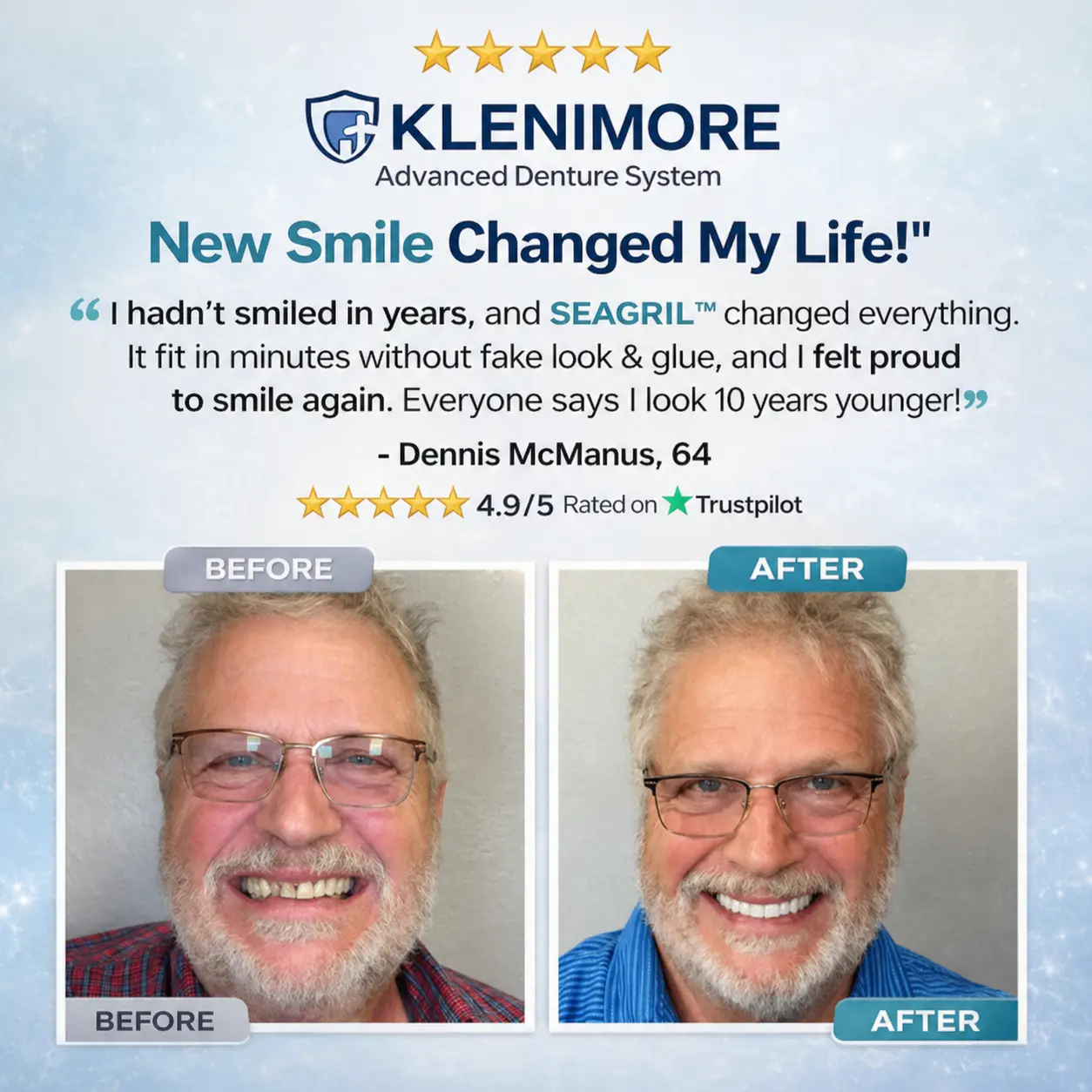 KLENIMORE™ Complete Dentures 2026 | Natural Fit Smile
