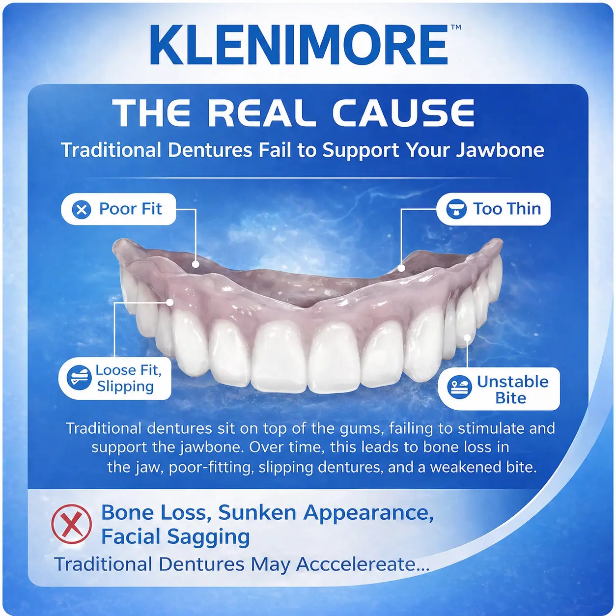 KLENIMORE™ Complete Dentures 2026 | Natural Fit Smile
