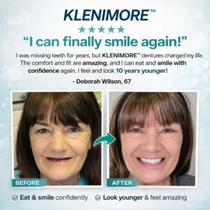 KLENIMORE™ Complete Dentures 2026 | Natural Fit Smile