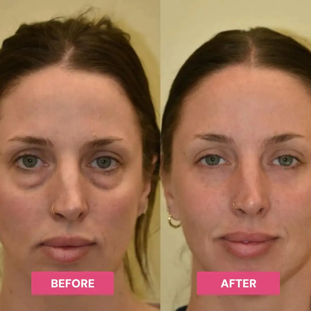 Korean PDRN Pink Collagen Volume Balm