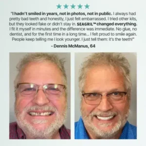 SEAGRIL™ Custom-Fit Full Functional Dentures