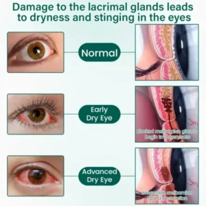 NEYEROS® OptiClear Nano Eye Roller Serum