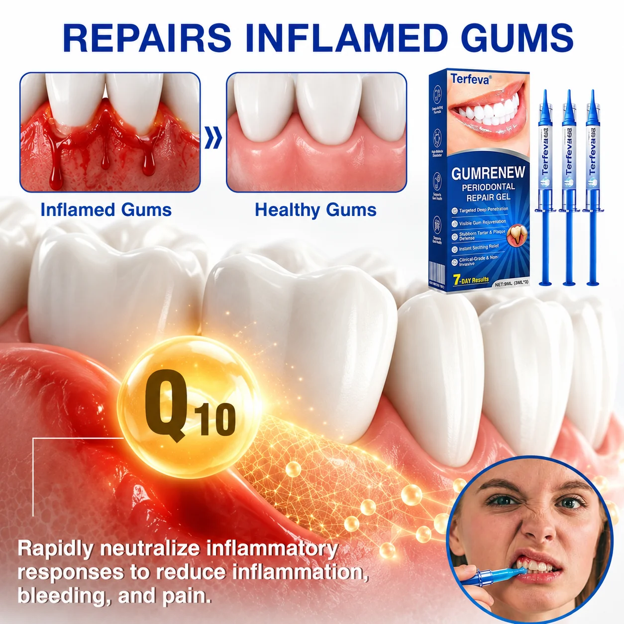 Terfeva® 𝗚𝘂𝗺𝗥𝗲𝗻𝗲𝘄 Periodontal Repair Gel