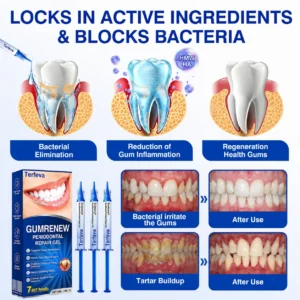 Terfeva® 𝗚𝘂𝗺𝗥𝗲𝗻𝗲𝘄 Periodontal Repair Gel
