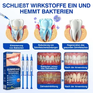 Glimmerly® GumRevive Parodontales Reparaturgel