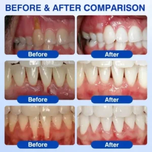 CureVivo® GumRevive Periodontal Repair Gel