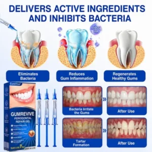 CureVivo® GumRevive Periodontal Repair Gel