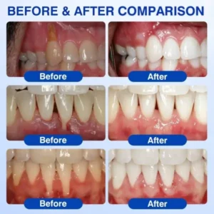 Dr.Era® GumRevive Advanced Gum Care Gel