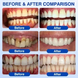 Dr.Era® GumRevive Advanced Gum Care Gel
