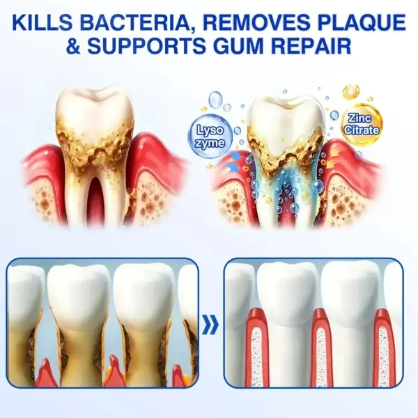 Evolvion GumCare Pro EMD Periodontal Gel | Gum Care