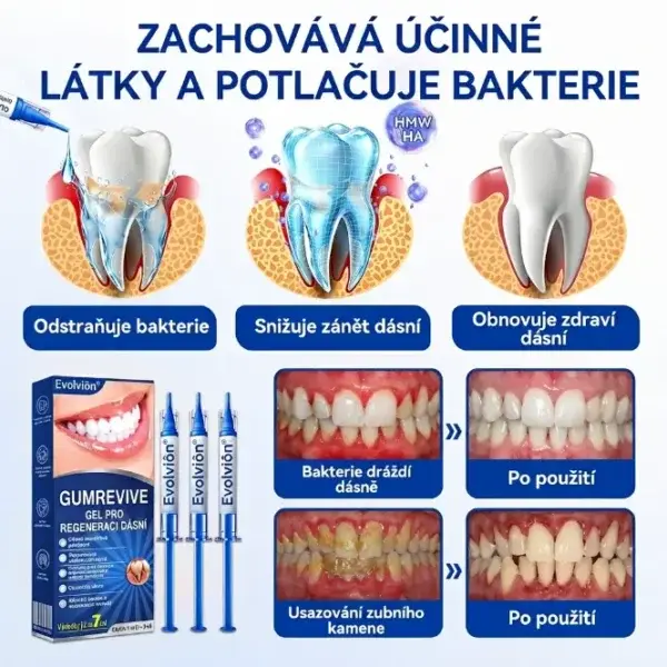 Evolvion® GumRevive Gel