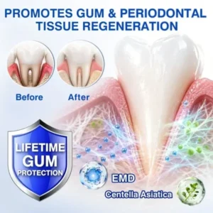 Evolvion GumVital Gum Care Gel