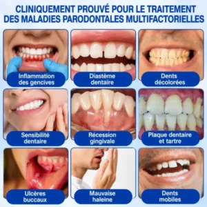 Gel Régénération Parodontale Glimmerly GumRevive