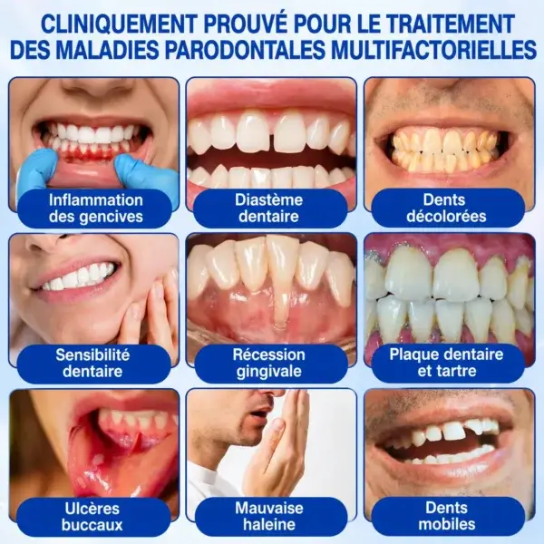 Gel Régénération Parodontale Glimmerly GumRevive