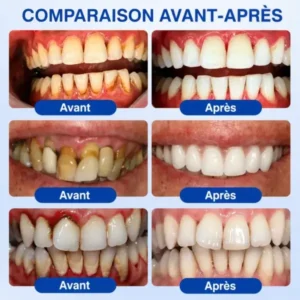 Gel Régénération Parodontale Glimmerly GumRevive