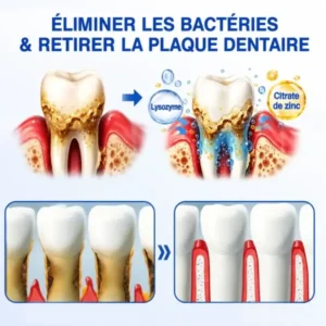 Gel Régénération Parodontale Glimmerly GumRevive