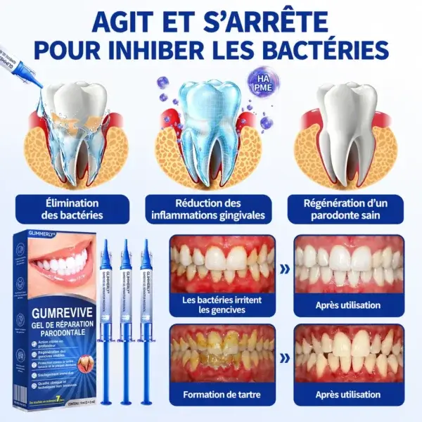 Gel Régénération Parodontale Glimmerly GumRevive