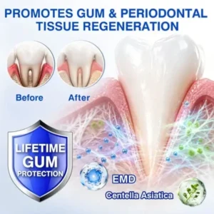 Natravor GumRevive Gum Regeneration Gel