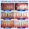 PureluxoÂŽ GumRevive Periodontal Repair Gel
