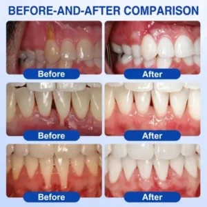 Pureluxo® GumRevive Periodontal Repair Gel