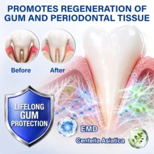 Pureluxo® GumRevive Periodontal Repair Gel