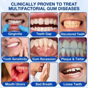 Pureluxo® GumRevive Periodontal Repair Gel